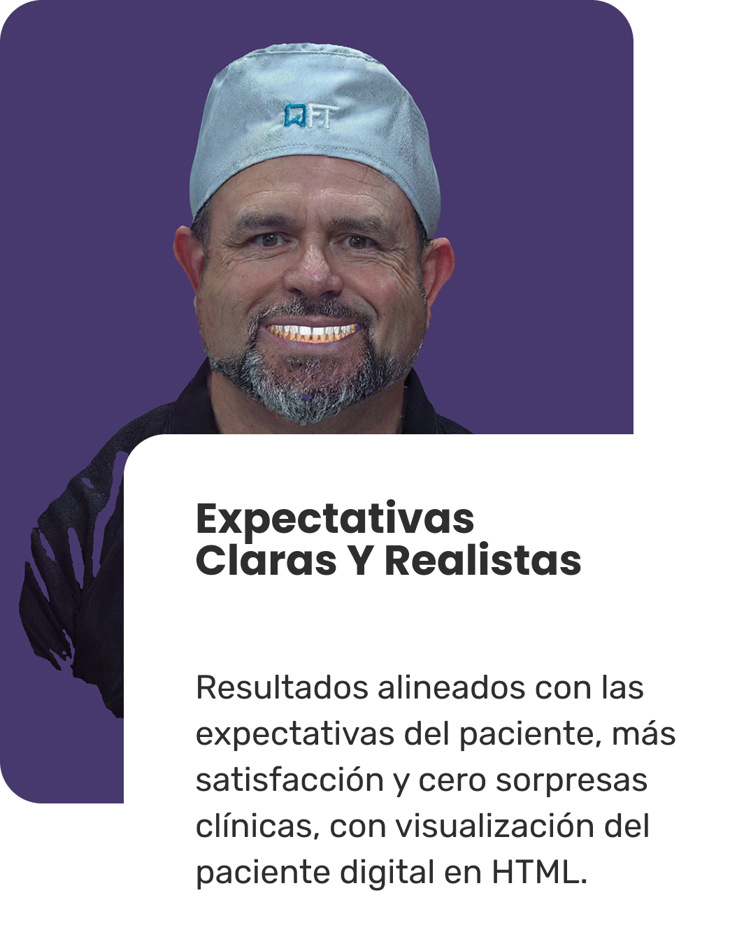 Expectativas claras y realistas en Carillas Dentales