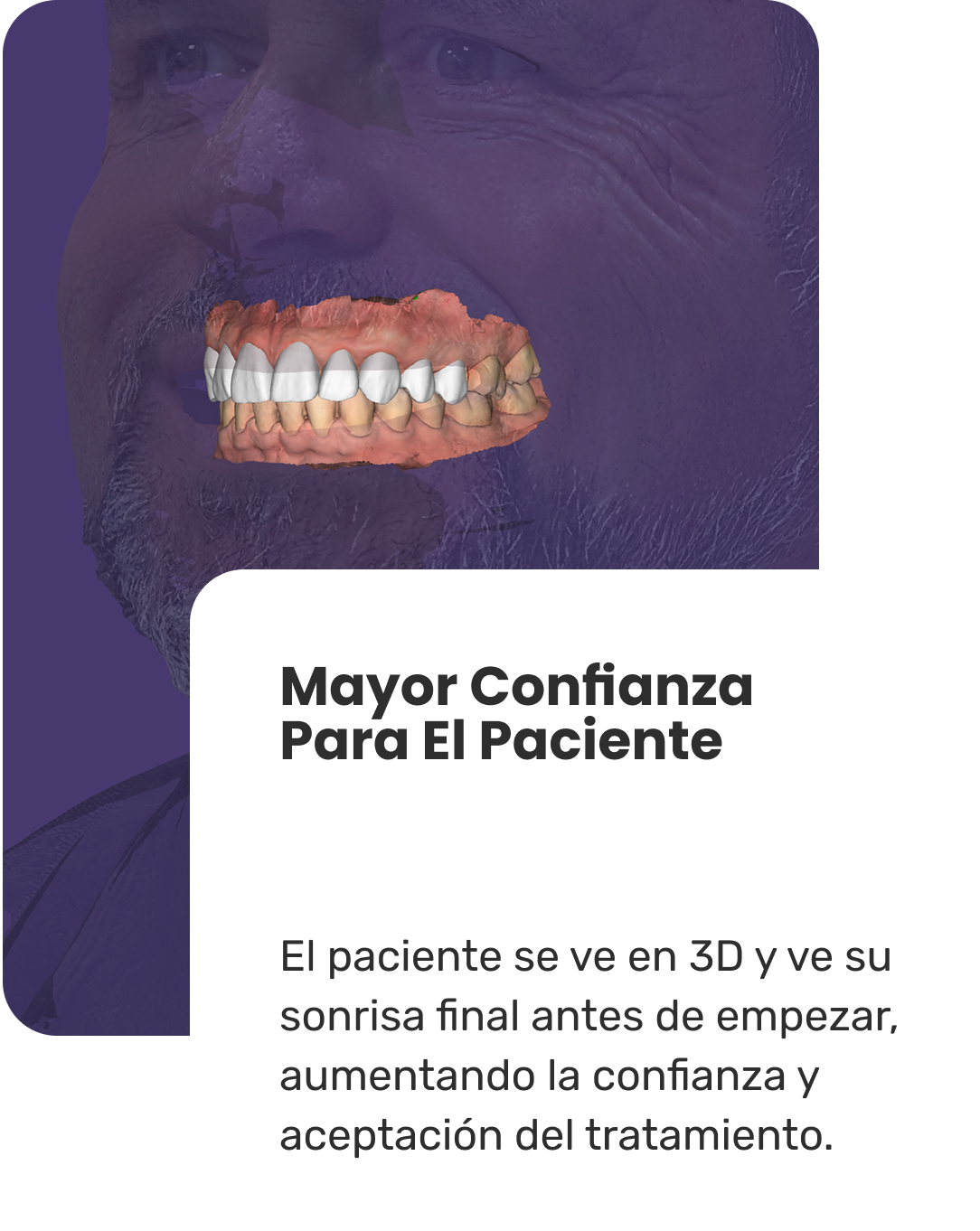 Mayor Confianza Para el Paciente en Carillas Dentales