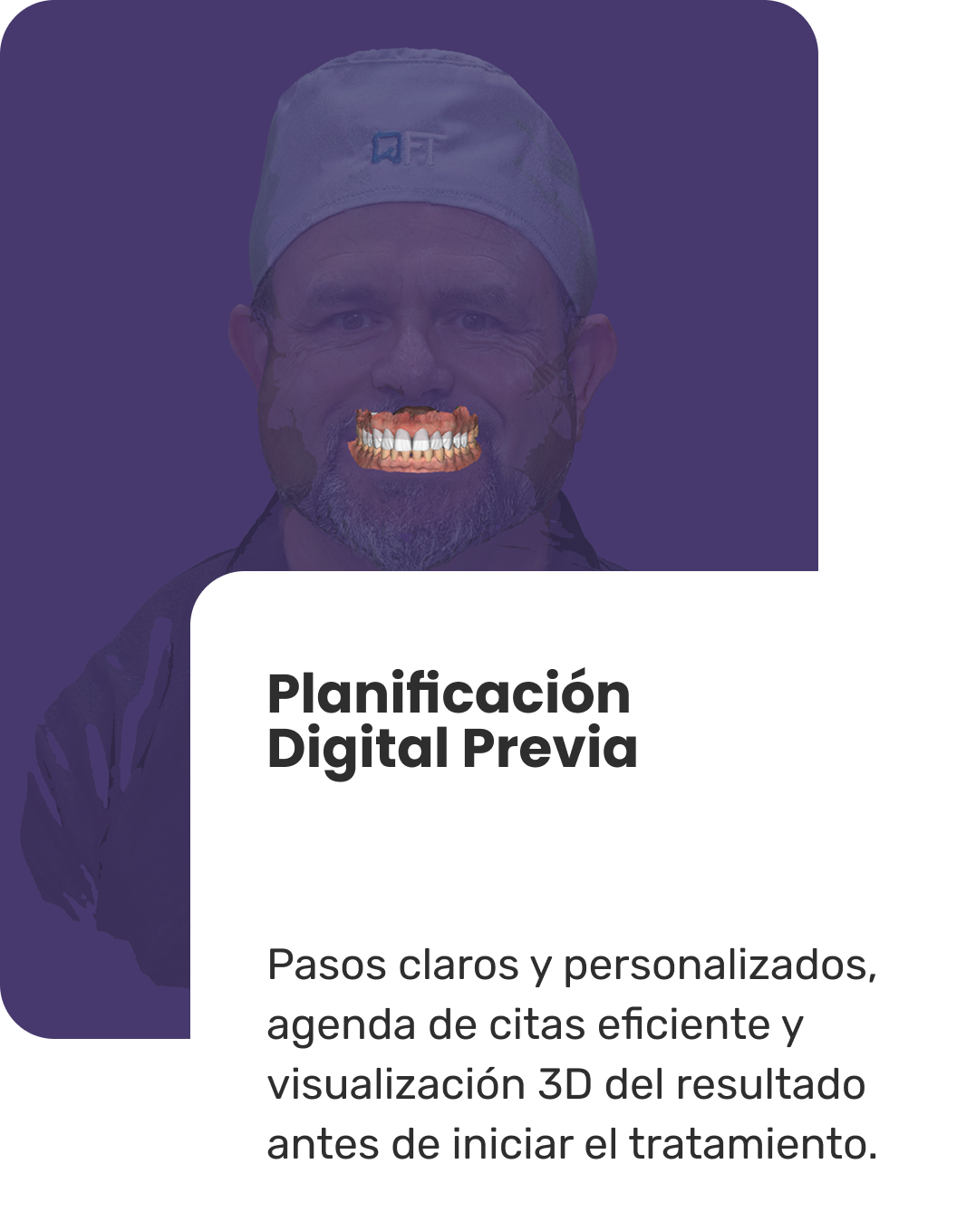 Planificación Digital Previa Carillas dentales